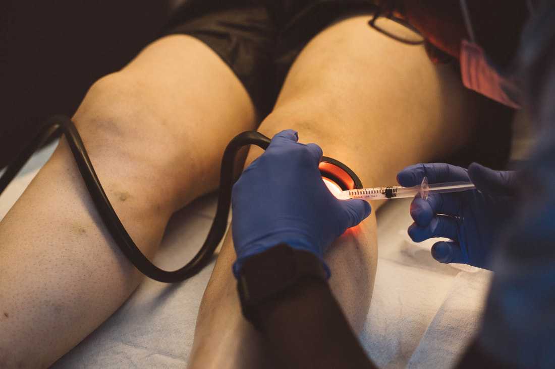 Sclerotherapy Vein Treatment With Vein Light